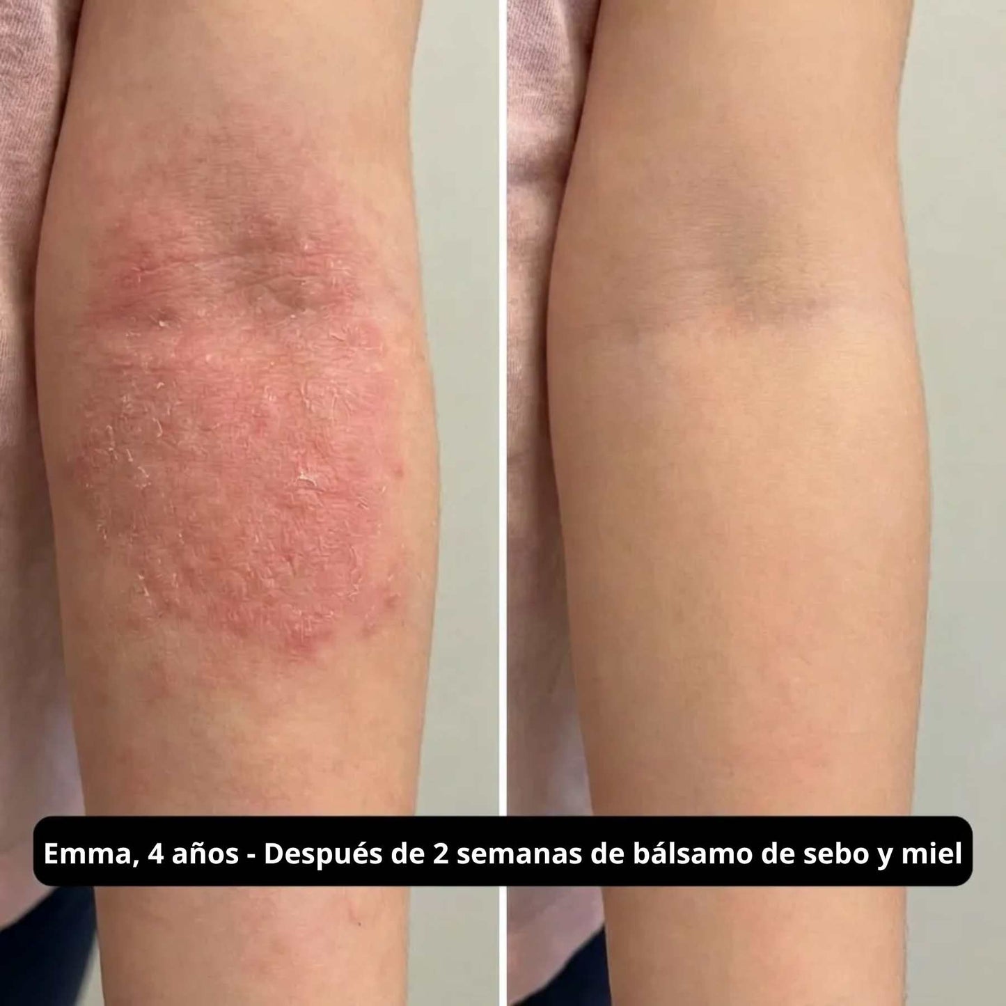 Bálsamo de sebo de res - 59 mL