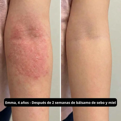 Bálsamo de sebo de res - 59 mL